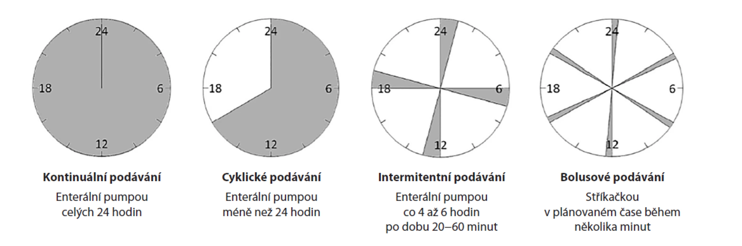Způsoby podávání sondové enterální výživy − upraveno dle Ichimaru [14]<br>
Fig. 1: Methods of delivering enteral tube feeding – adapted according to Ichimaru [14]