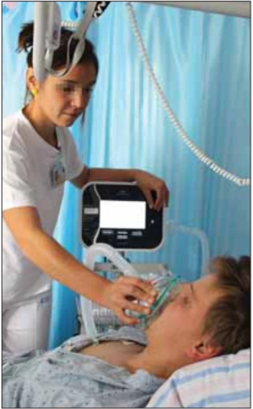 Mechanická insufl ace – exsufl ace
pomocí přístroje CoughAssist, aplikovaná
terapeutem. Fotografi e byla pořízená s informovaným souhlasem pacienta.<br>
Fig. 7. Mechanical insuffl ation – exsuffl ation performed by a therapist using the
CoughAssist device. The picture was
taken with informed consent from the
patient.