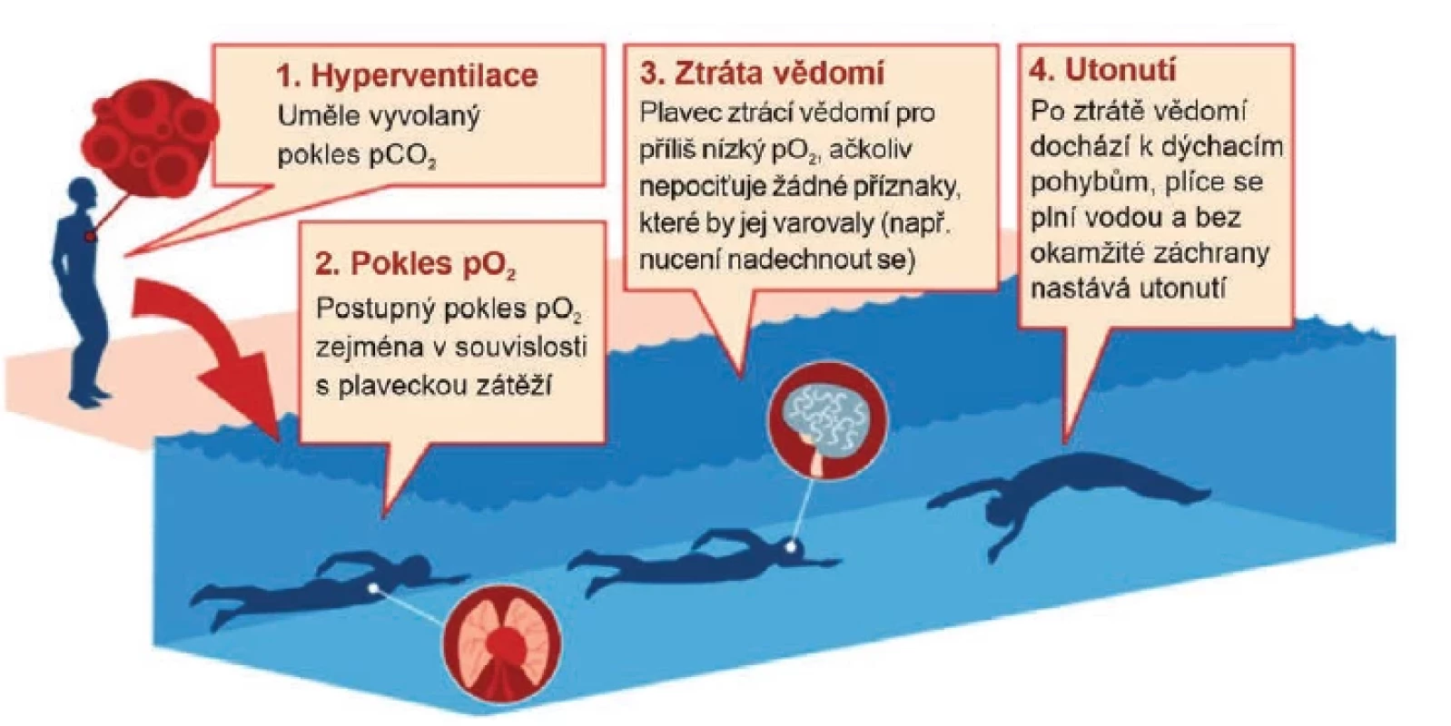 Potápěčský blackout (hypoxická ztráta vědomí) v mělké vodě – jak k němu dojde?