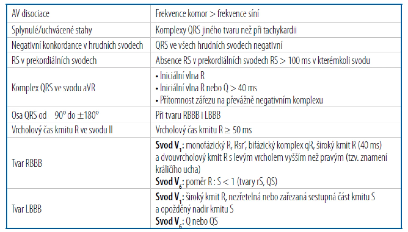 Klíčová EKG kritéria naznačující spíše komorovou než supraventrikulární tachykardii
při tachykardii se širokým komplexem QRS [1]