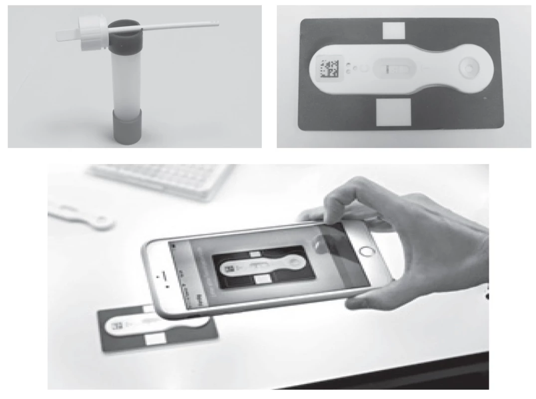 CalproSmart diagnostic Kit for home measurement of fecal calprotectin concentrations