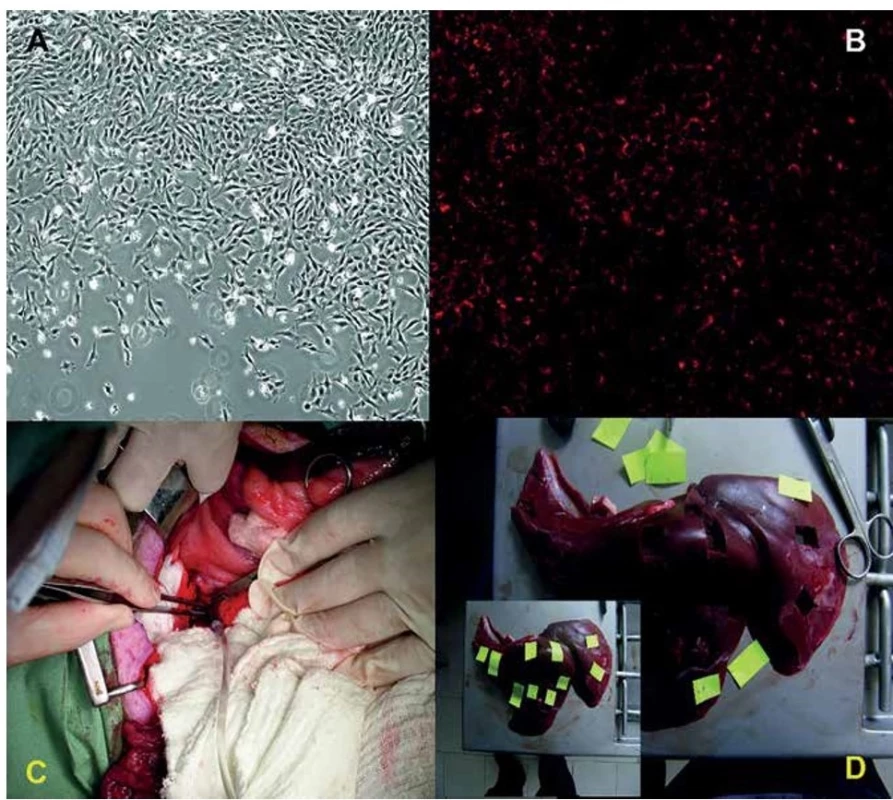 Tracking of mesenchymal stem cells on the culture plastic dish just before transplantation by CM-DiI staining<br>
Phase contrast (A) or fluorescence microscopy (B) (100x magnification). Administration of tracked MSCs into the portal vein via
the catheter under standard laparotomy. Sampling (2 samples from each lobe, 10 samples in total) of the liver after whole-body
perfusion of the animal.