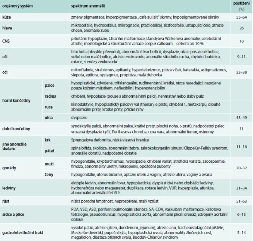 Vrozené vývojové anomálie u pacientů s Fanconiho anémií. Upraveno podle [31]