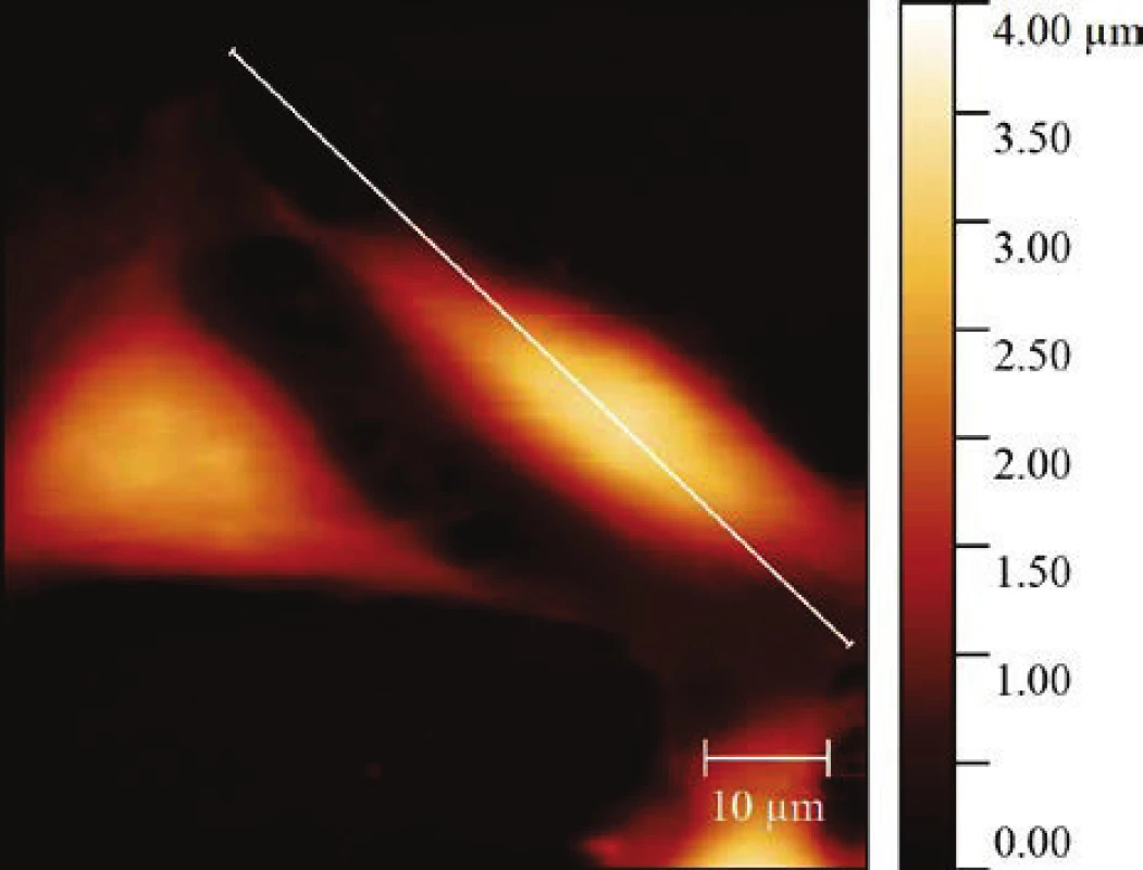 Atomic force microscopy of the HeLa cells height
profile treated by 5 Jcm-2 ZnPc PDT. The topography
image was obtained by PeakForce QNM (Quantitative
Nanomechanical Mapping) scanning mode at 0.1–0.2
Hz scanning rate and 1000 nm PeakForce amplitude.