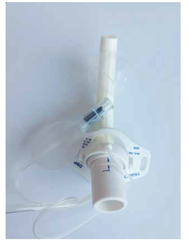 Dvouplášťová kanyla s manžetou.<br>
Fig. 1. Double plastic tracheostomy tube with a cuff.