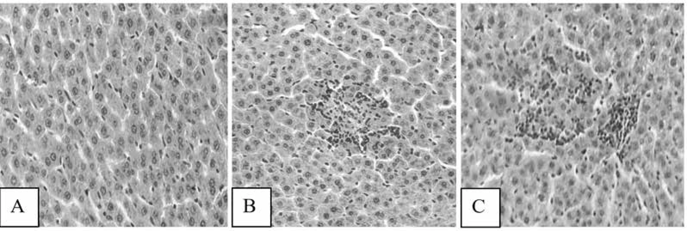 Photomicrographs of samples of liver tissues of rats treated with GlukvamineTM (A), GA h/ch
(B) and Q (C): A – the normal arrangement of hepatocytes, B, C – small foci of hepatocyte necrosis
(HX&E × 200)