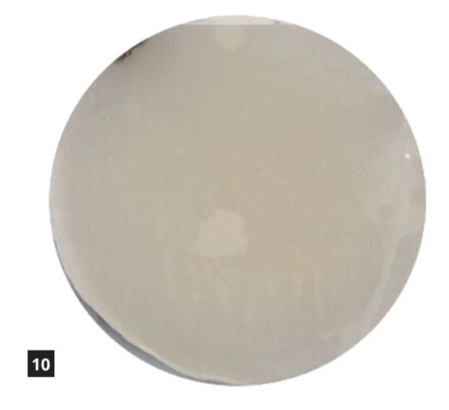 Filtek Ultimate vystavený kyselému pH po dobu 14 dnů<br>
Fig. 10 Filtek Ultimate exposed to acidic pH for 14 days