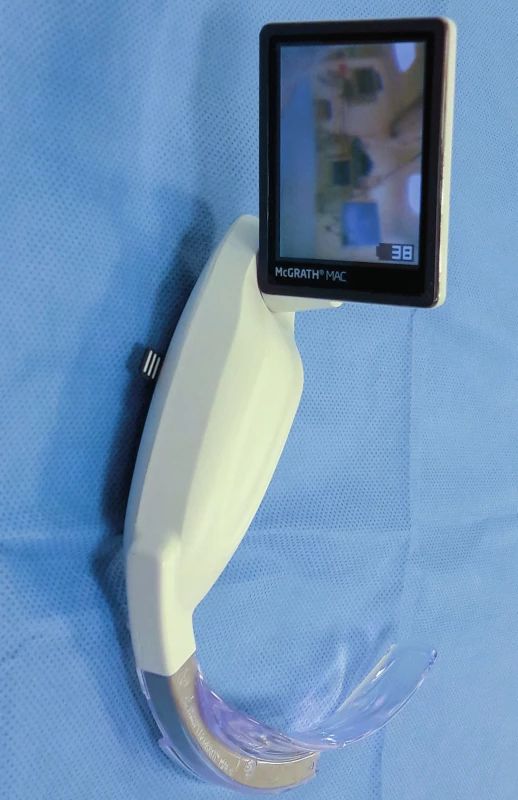 Videolaryngoskop McGrath (Medtronic Inc., Minneapolis, USA),
který je určený také pro urgentní příjem a přednemocniční péči
