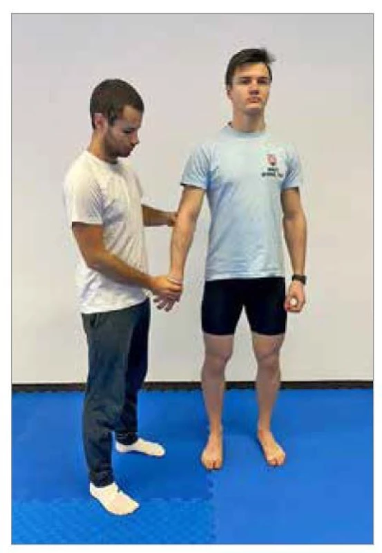 Mill test – vyšetrovací
manéver.<br>
Fig. 2. Mill test – clinical maneuver.
