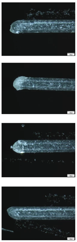 a–2d Variabilita v morfologii vláken
různých zubních kartáčků
zobrazená pomocí konfokální
mikroskopie (zdroj: archiv
doc. Roubalíkové)<br>
Fig 2a–2d Variability in fiber morphology
of different toothbrushes
imaged by confocal microscopy
(source: archives
Assoc. Prof. Roubalíková)