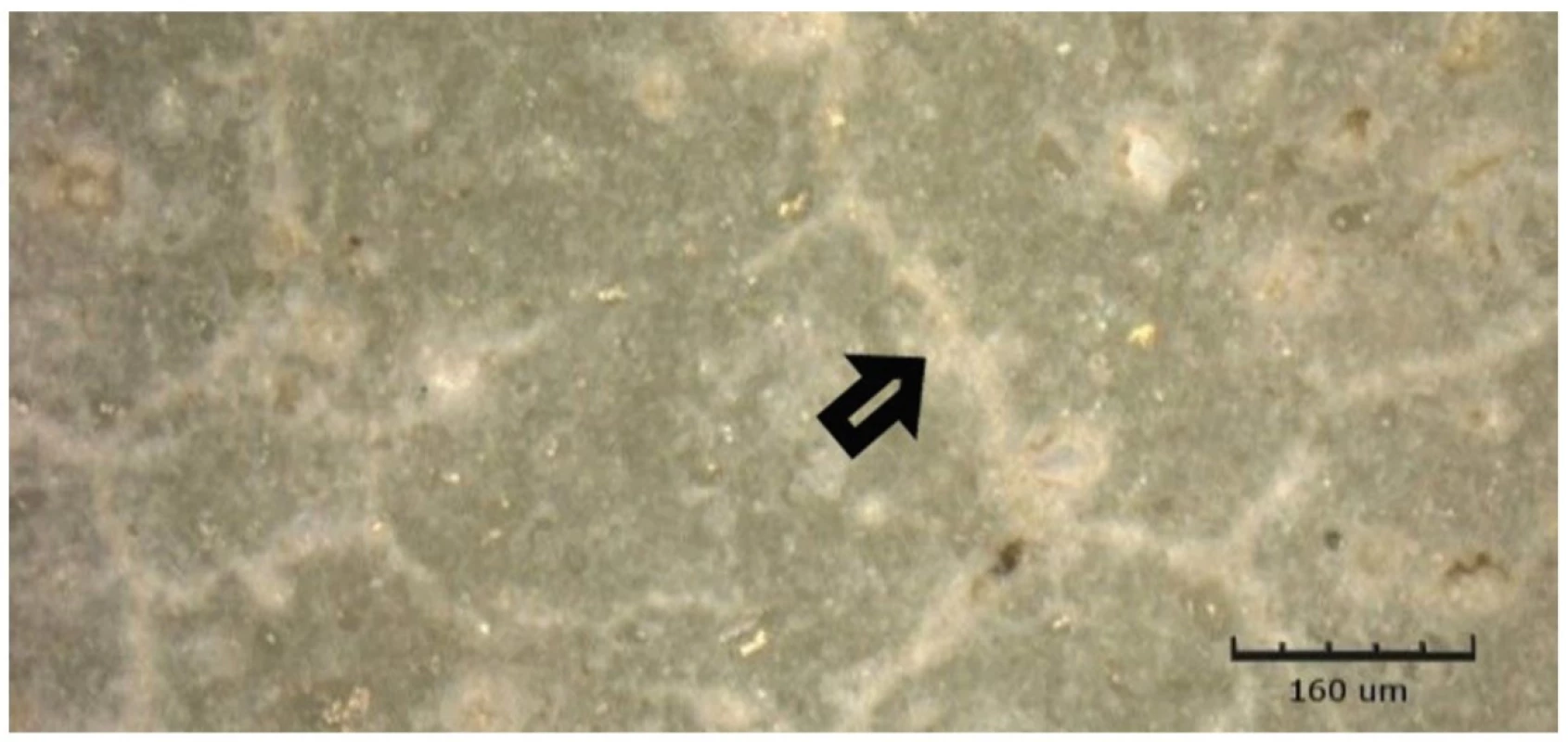 Kontrolní vzorek Harvard Ionoresin Fill ve vodě, zobrazeno CLSM<br>
Fig. 3 Harvard Ionoresin Fill control in water, shown by CLSM