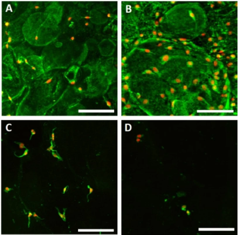 Melanocyte adhesion to the nanofibers. Adhesion of melanocytes was visualized using confocal
microscopy on day 1. Cytoplasm is stained with DiOC6 (green), nuclei with propidium iodide (red). A – PCL,
B – PCL/PL, C – PVA, D – PVA/PL. Objective 20×,
scale bar 100 µm.