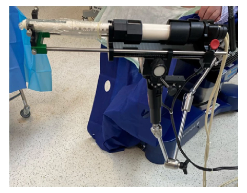 Rameno stepperu s fixovanou transrektální
ultrazvukovou sondou (archiv autora)<br>
Fig. 3. Stepper arm with an attached transrectal
ultrasound probe (author’s archive)