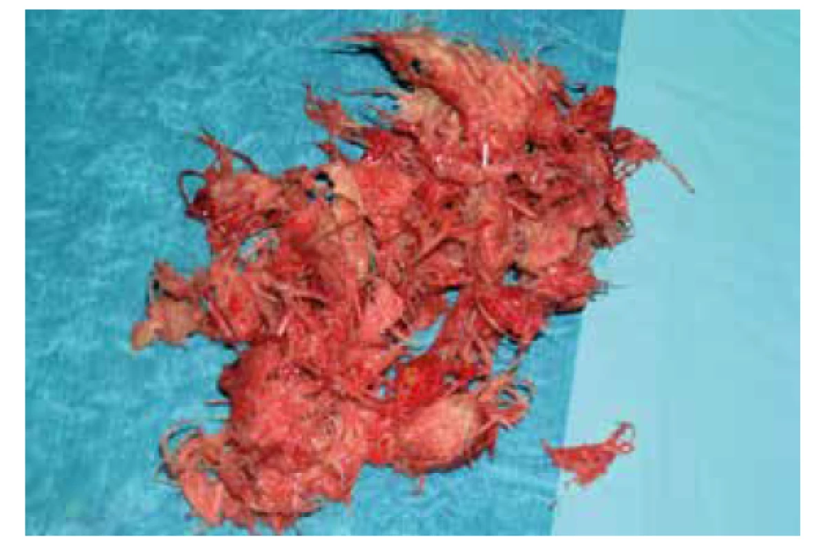 Obsah dutiny (peří)<br>
Fig. 7: Cavity content (feathers)