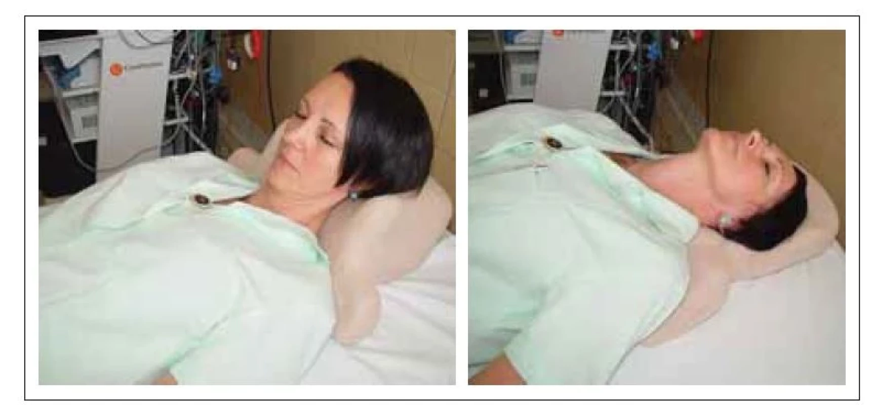 Předklon a záklon krční páteře s využitím speciální podložky.<br>
Fig. 1. Flexion and extension of cervical spine with the use of a special pad.