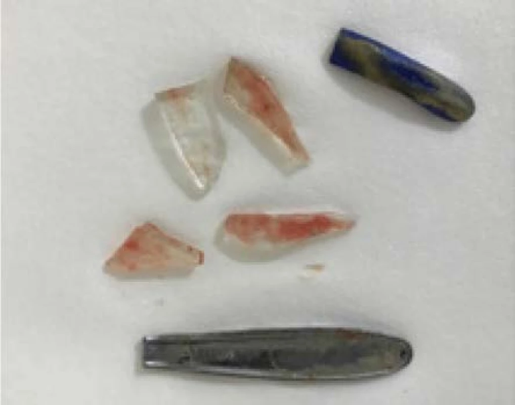 1× plastový válcový úlomek, 4× skleněné
střepiny, 1× přelomená zadní část čajové lžičky<br>
Fig. 1. A plastic cylindrical fragment x1; glass shards
x4; broken back part of a teaspoon x1