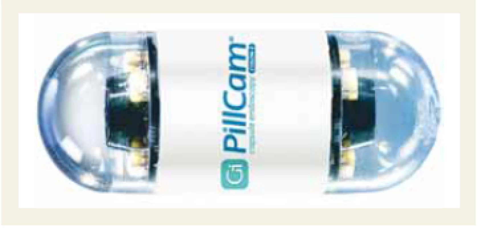 Kolonické kapsle PillCam
COLON 2.<br>
Fig. 1. PillCam COLON 2 colon capsule.