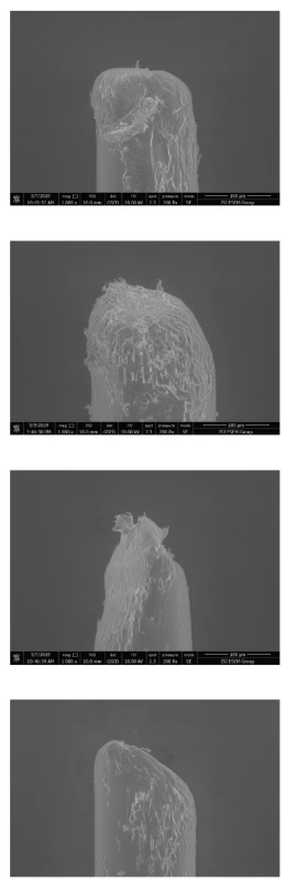 a–3d Variabilita v morfologii
vláken různých zubních
kartáčků zobrazená pomocí
elektronové mikroskopie<br>
(zdroj: archiv
doc. Roubalíkové)<br>
Fig 3a–3d Variability in fiber morphology
of different toothbrushes
imaged by electron microscopy<br>
(source: archives
Assoc. Prof. Roubalíková)