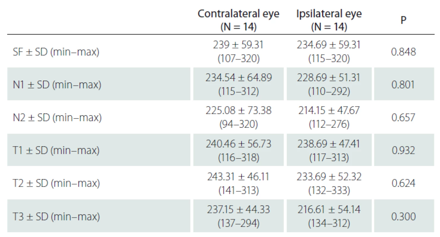 The comparison of choroidal thickness values of the eyes in subjects with
unilateral carotid artery disease.