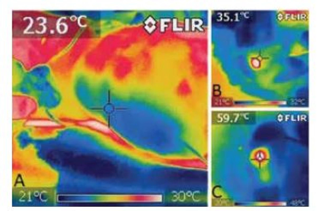 Termokamera – při zavádění laserového vlákna do VSP