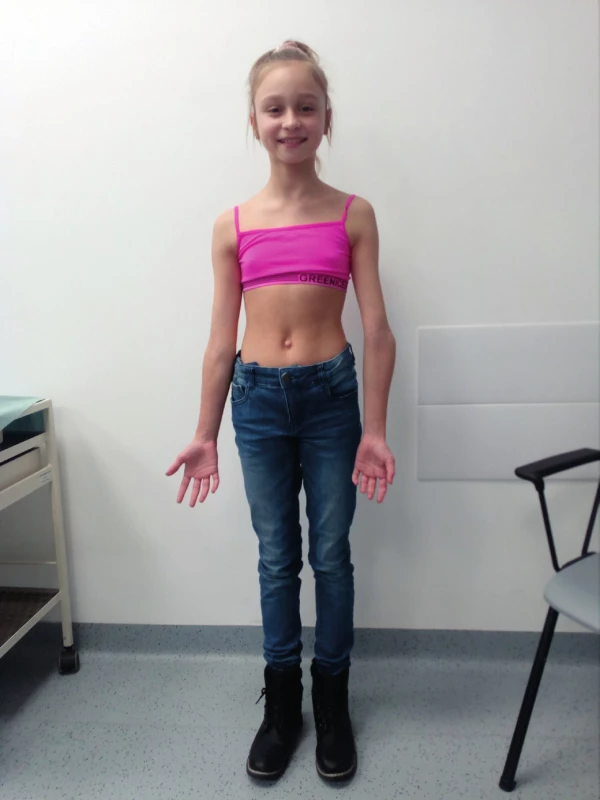 Same patient at 10 years of age
