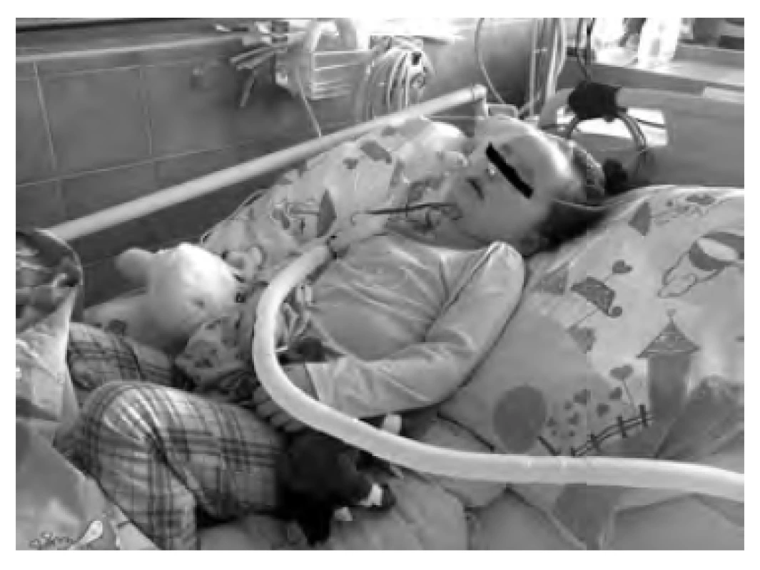 Intenzivní rehabilitační
péče je u pacientů se získaným
poškozením mozku stěžejní