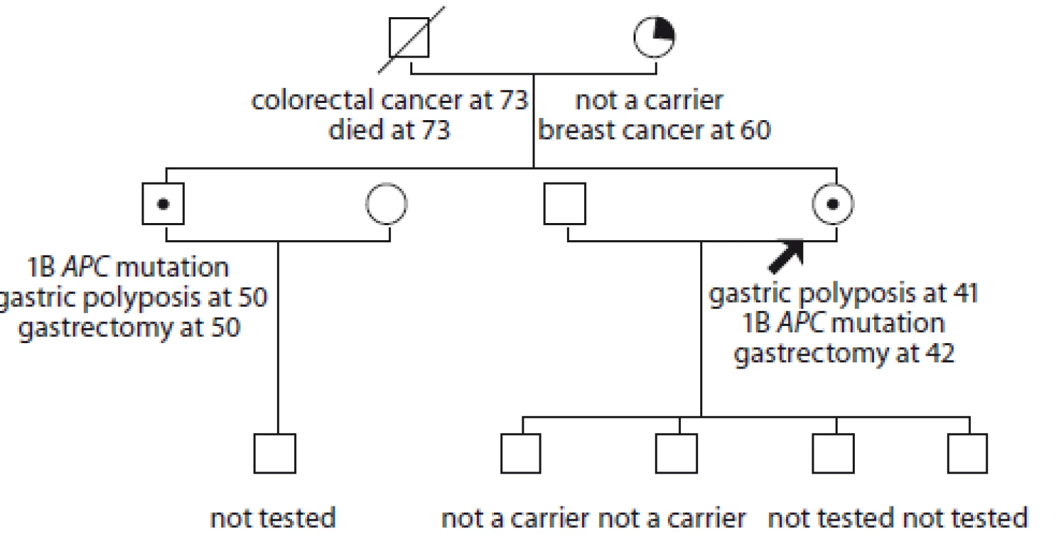 Pedigree of family no. 3 (Masaryk Memorial Cancer Institute).