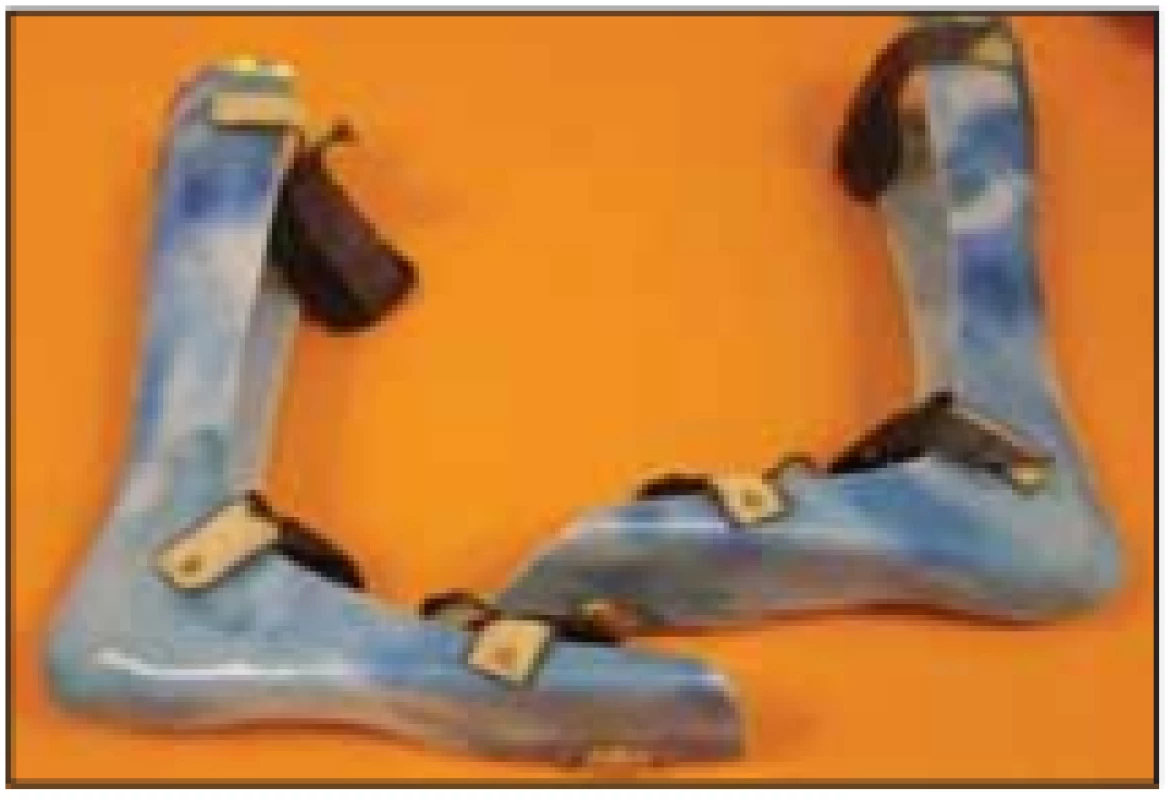 Polohovací ortéza AFO do vozík.<br>
Fig. 1. Adjustable orthosis for a wheelchair.