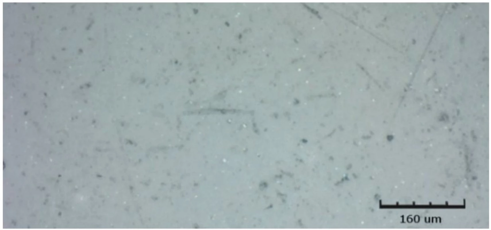 Filtek Ultimate vystavený kyselému pH po dobu 14 dnů, zobrazeno CLSM<br>
Fig. 12 Filtek Ultimate exposed to acidic pH for 14 days, shown by CLSM
