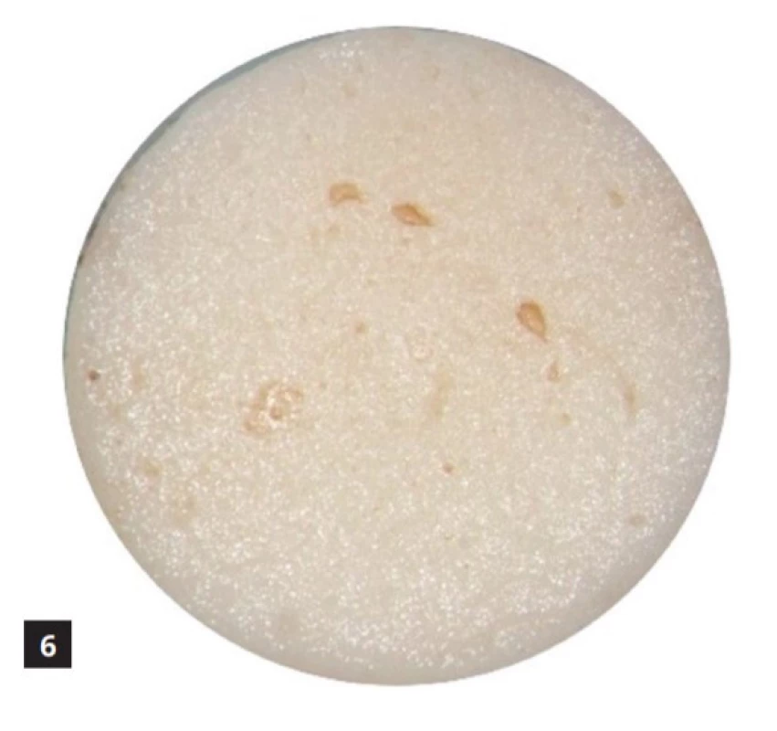 Omnifill C vystavený kyselému pH po dobu 14 dnů <br>
Fig. 6 Omnifill C exposed to acidic pH for 14 days