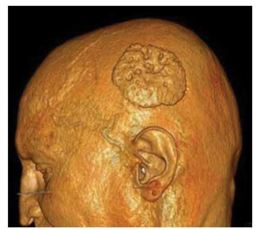 3D CT zobrazení oblasti