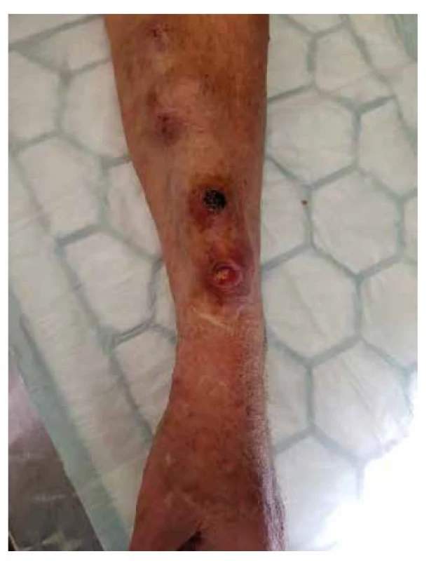 Defekty AVF<br>
Fig. 1: AVF defects