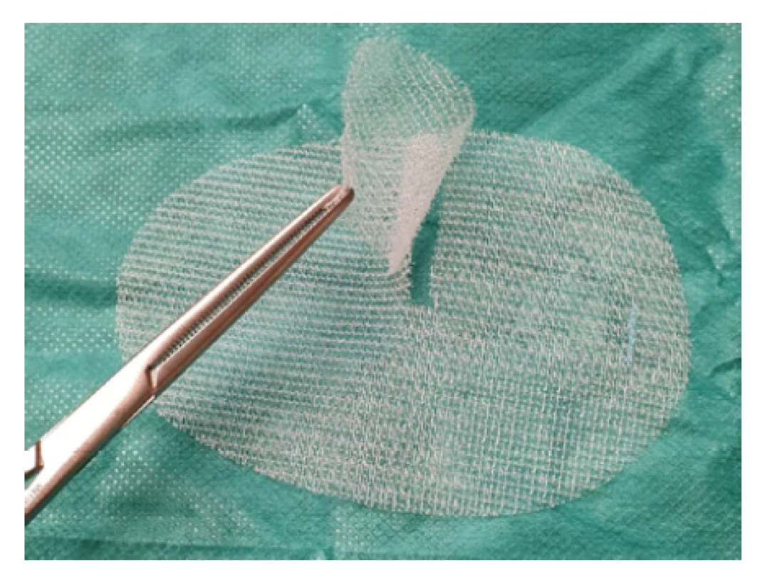 Síťka ProGrip™ pravostranná<br>
Fig. 6. Right side mesh ProGrip™