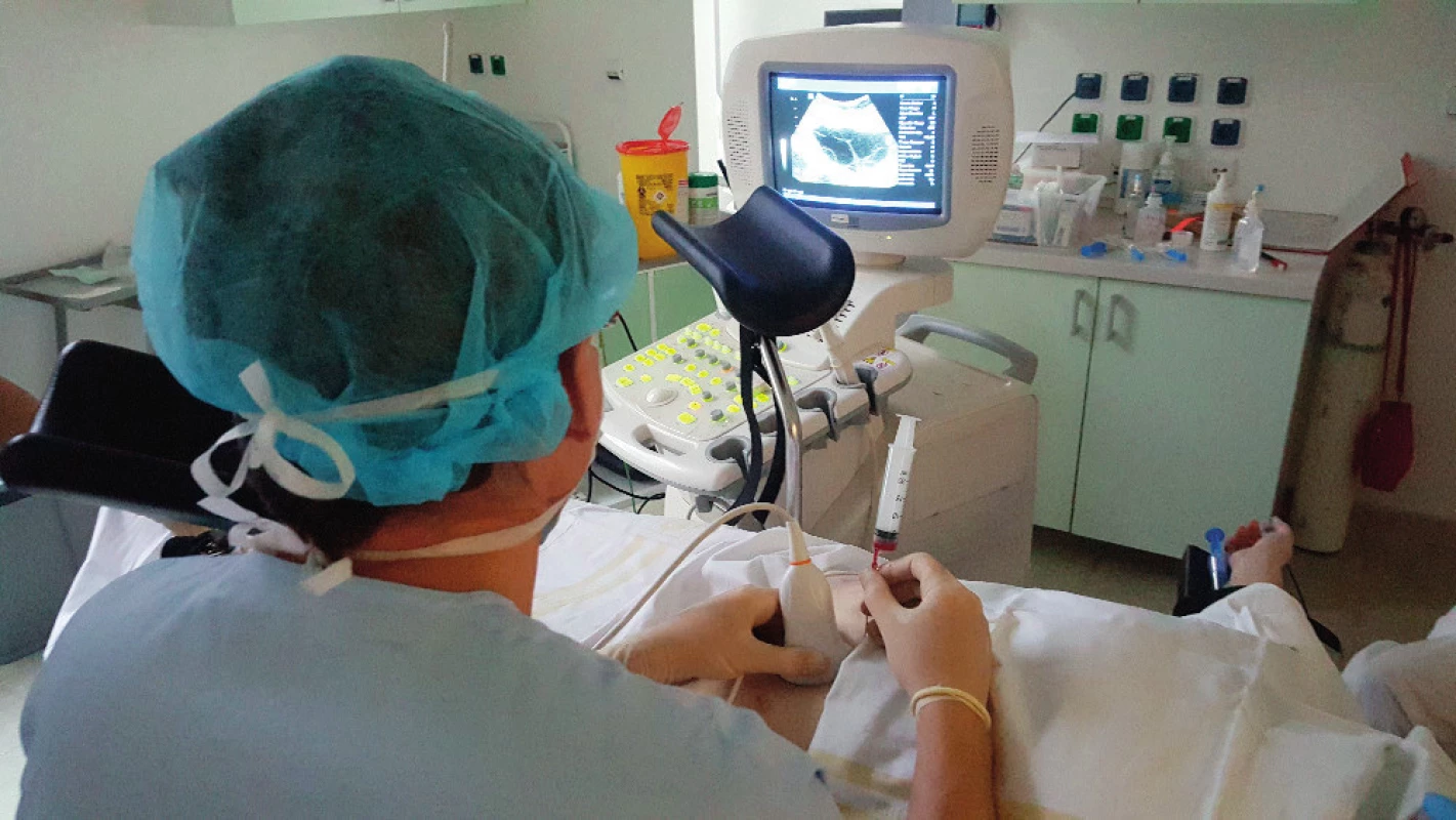 Technika punkce folikulárni tekutiny transabdominální cestou