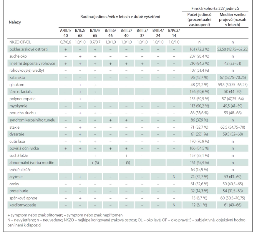 Projevy hereditární gelsolinové amyloidózy u osmi jedinců pozitivně testovaných na přítomnost patogenní mutace v genu GSN.
Projevy onemocnění jsou porovnány s finskou kohortou 227 jedinců [2]. Jednici jsou označeni dle obr. 1 (A rodina slovenského původu,
B rodina českého původu) a seřazeni dle klesajícího věku. Údaje o postižení sluchu byly získány pouze anamnesticky, audiogram nebyl
proveden.