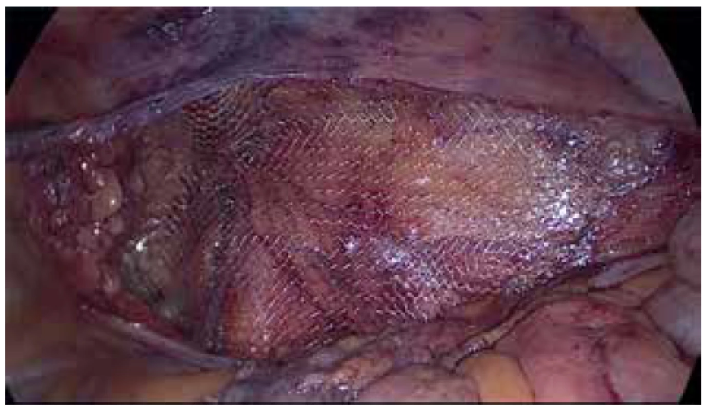 Uložení síťky<br>
Fig. 3. Position of the mesh