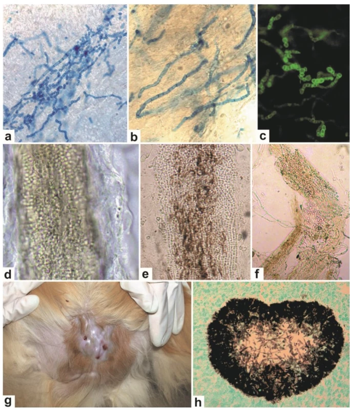 Laboratorní diagnostika dermatofytóz pomocí přímé mikroskopie a histologie.