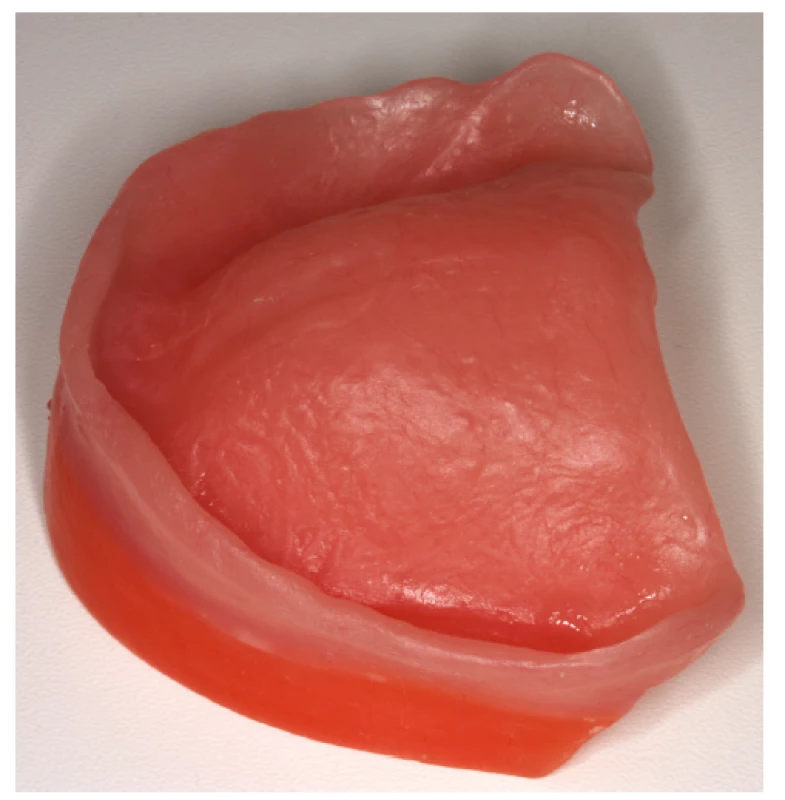 Definitivní deska opatřená
voskovým valem<br>
Fig. 2
Definitive basis
with wax wall