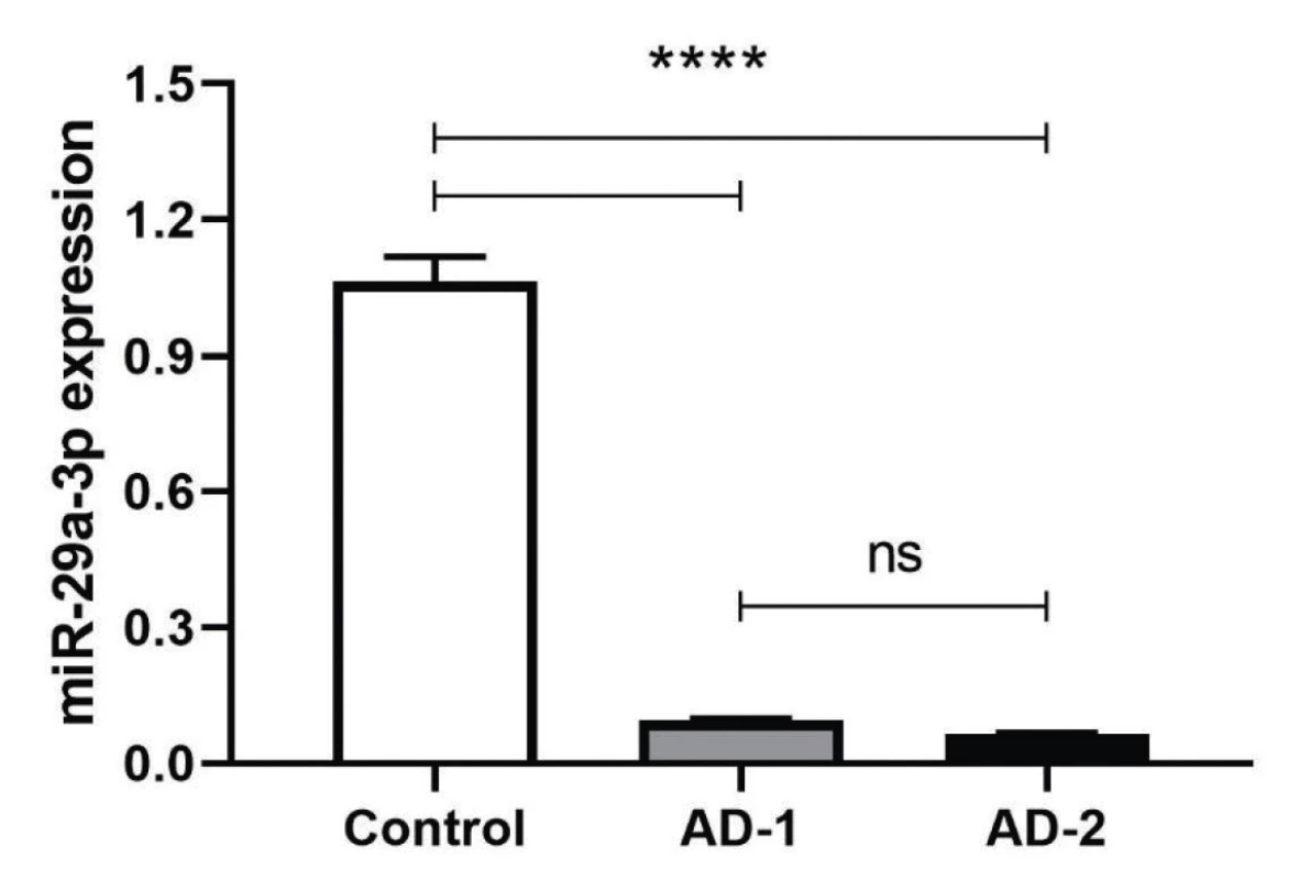  After 48 h posttransfection, miR-29a-3p transcriptional
expression was measured and normalized with internal control,
Snord47 small nuclear RNA. The expression level of miR-29a-3p
was significantly different in compared to scrambled control
(****P < 0.0001)
The values are expressed as Mean ±SD. All experiments were
repeated three times.