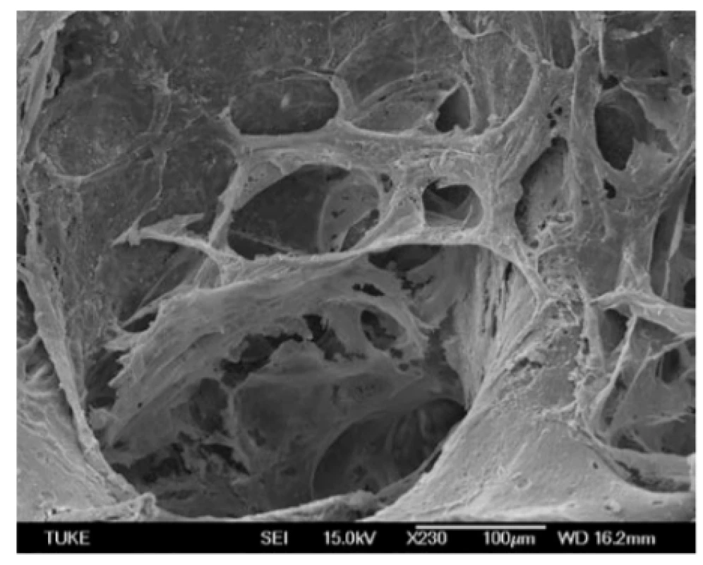 The surfaces of bovine bone tissue without
hMSCs.