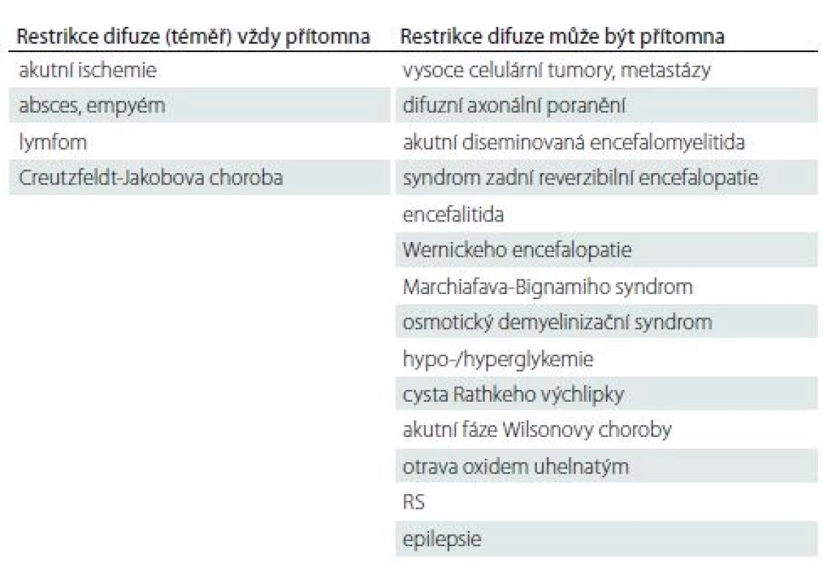 Přehled onemocnění s restrikcí difuze na MR mozku u dospělých.