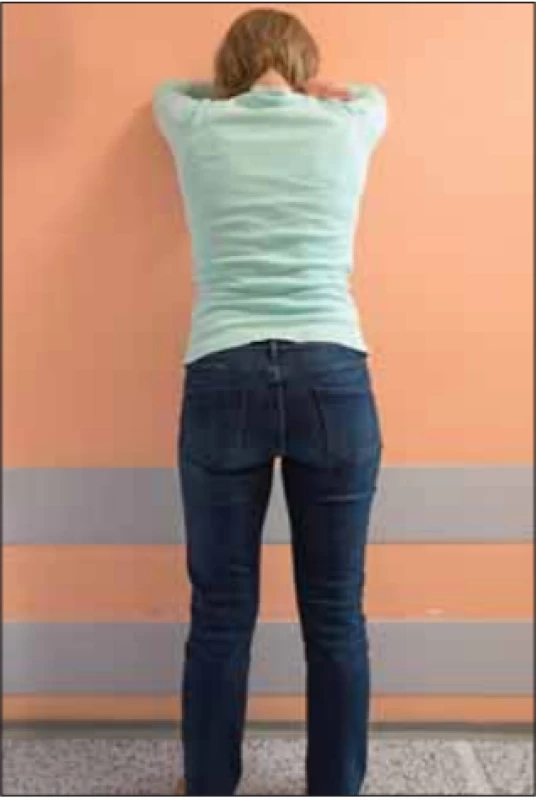 Úlevová poloha ve stoji s oporou
horních končetin o zeď. Fotografi e byla
pořízená s informovaným souhlasem
pacientky.<br>
Fig. 5. Breath relief standing position with
upper limbs supported by a wall. The
picture was taken with informed consent
from the patient.