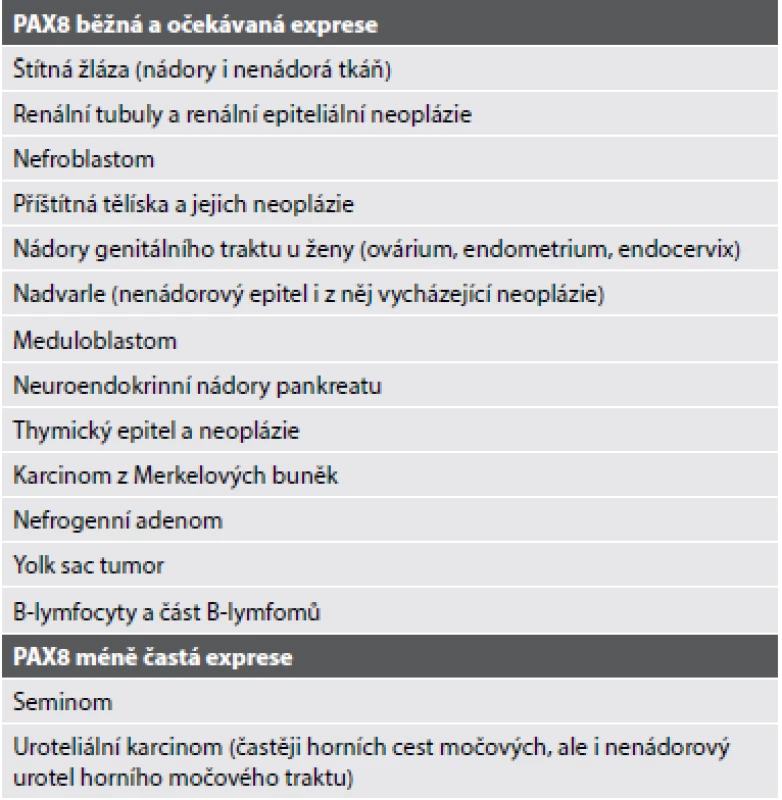 Exprese PAX8 různými tkáněmi a nádor – převzato Cox et kol. (8).