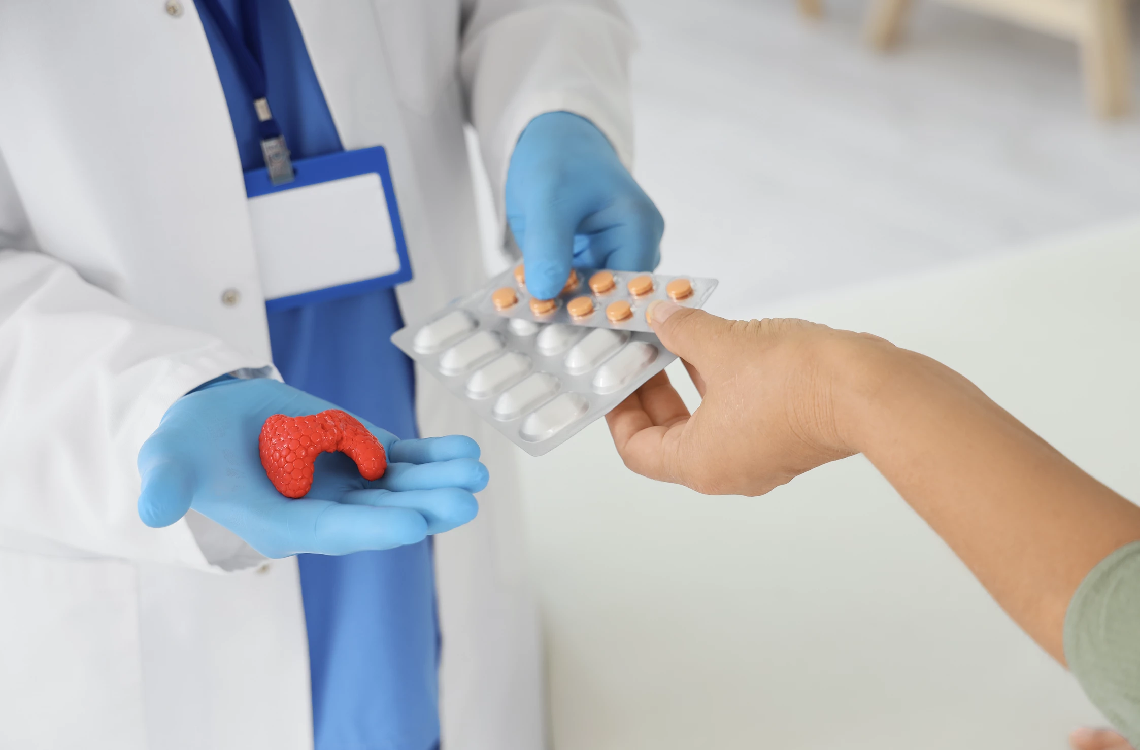 Titrace substitučních dávek levothyroxinu u mladé pacientky s papilárním karcinomem ŠŽ – kazuistika