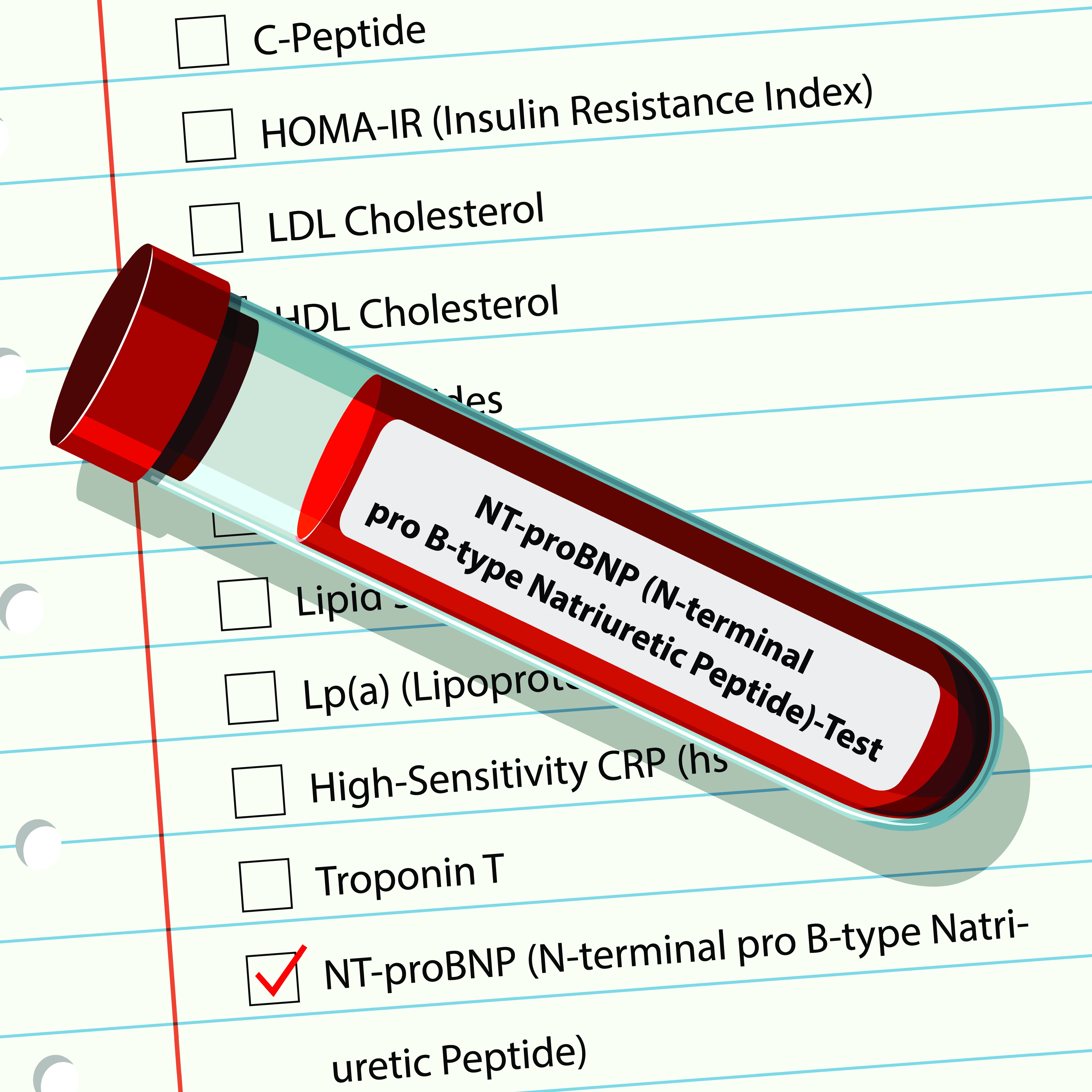 Biomarker NT-proBNP má v praxi široké využití. Usnadněte si jeho vyšetření POCT analyzátorem Afias 1