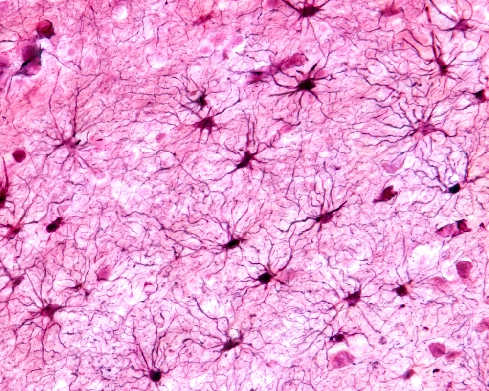 Vidoucí nevidoucí, Alzheimer v krvi, obézní gen a emocionální vzpomínky – „jednohubky“ z výzkumu 35/2025