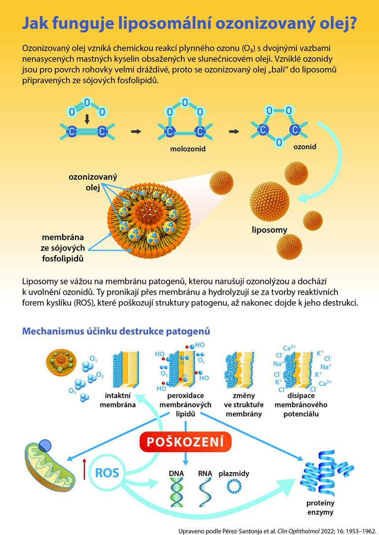 INFOGRAFIKA: Jak funguje liposomální ozonizovaný olej v léčbě očních infekcí?
