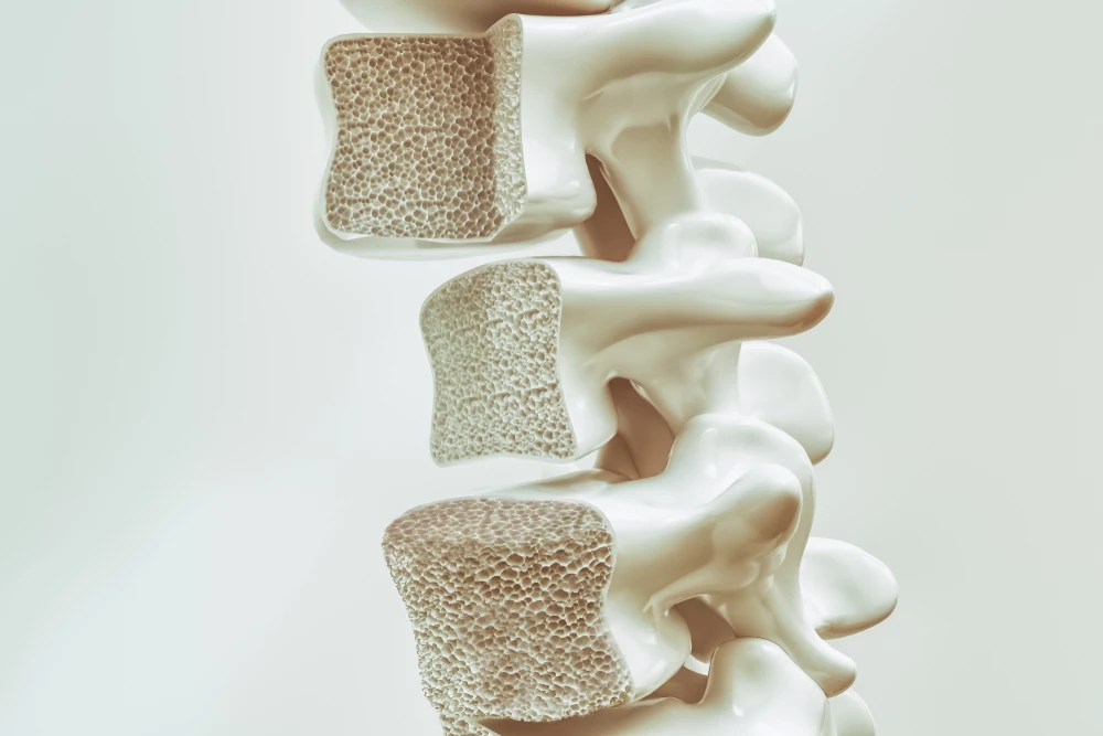 Diagnostika osteoporózy v kontextu současných doporučení