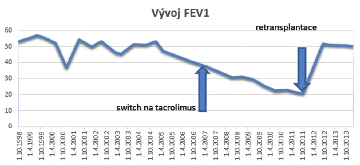 Graf 1. Vývoj FEV1 Graph 1. FEV1 development