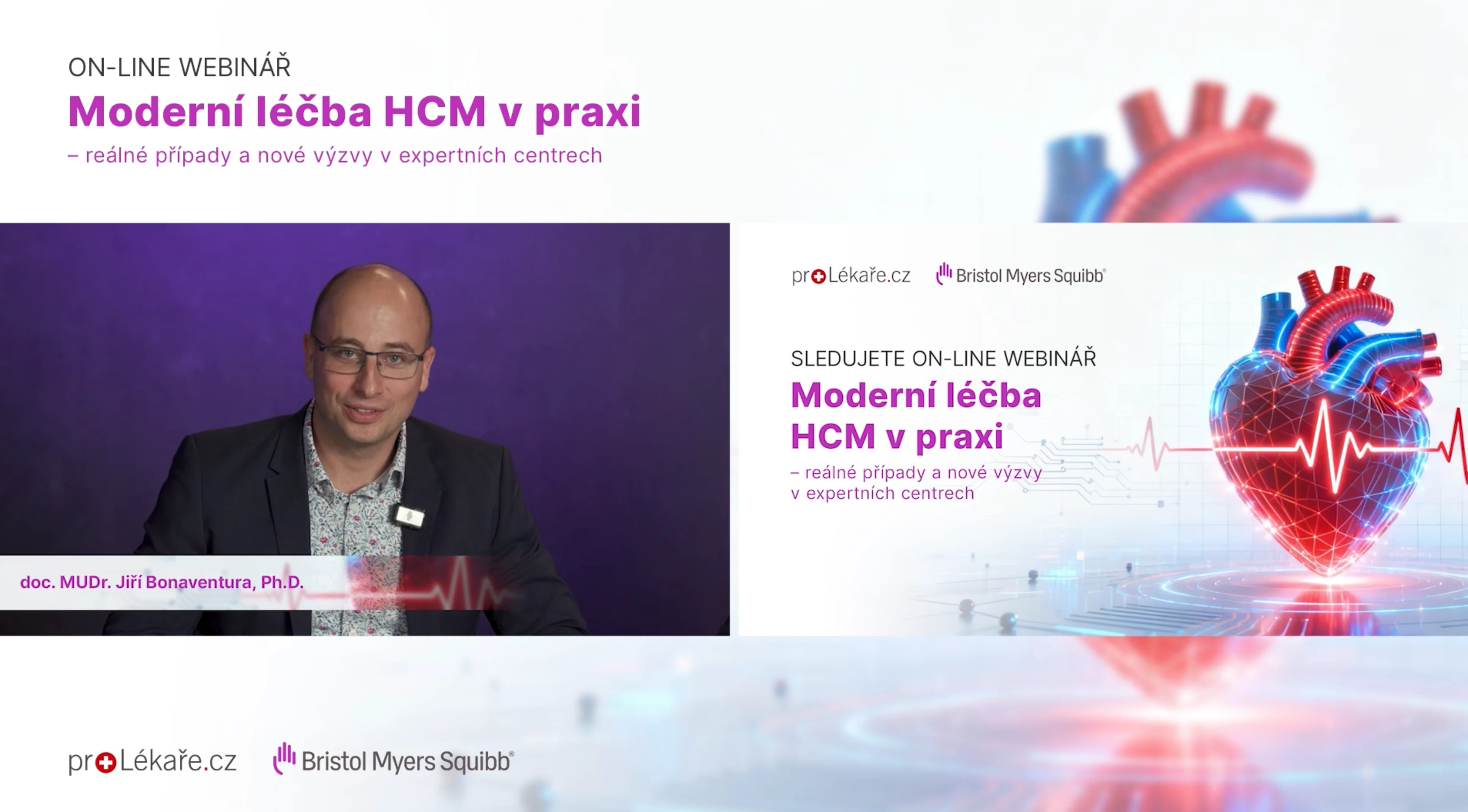 VIDEOWEBINÁŘ: Specifická terapie obstrukční HCM v praxi – zkušenosti expertů z českých center